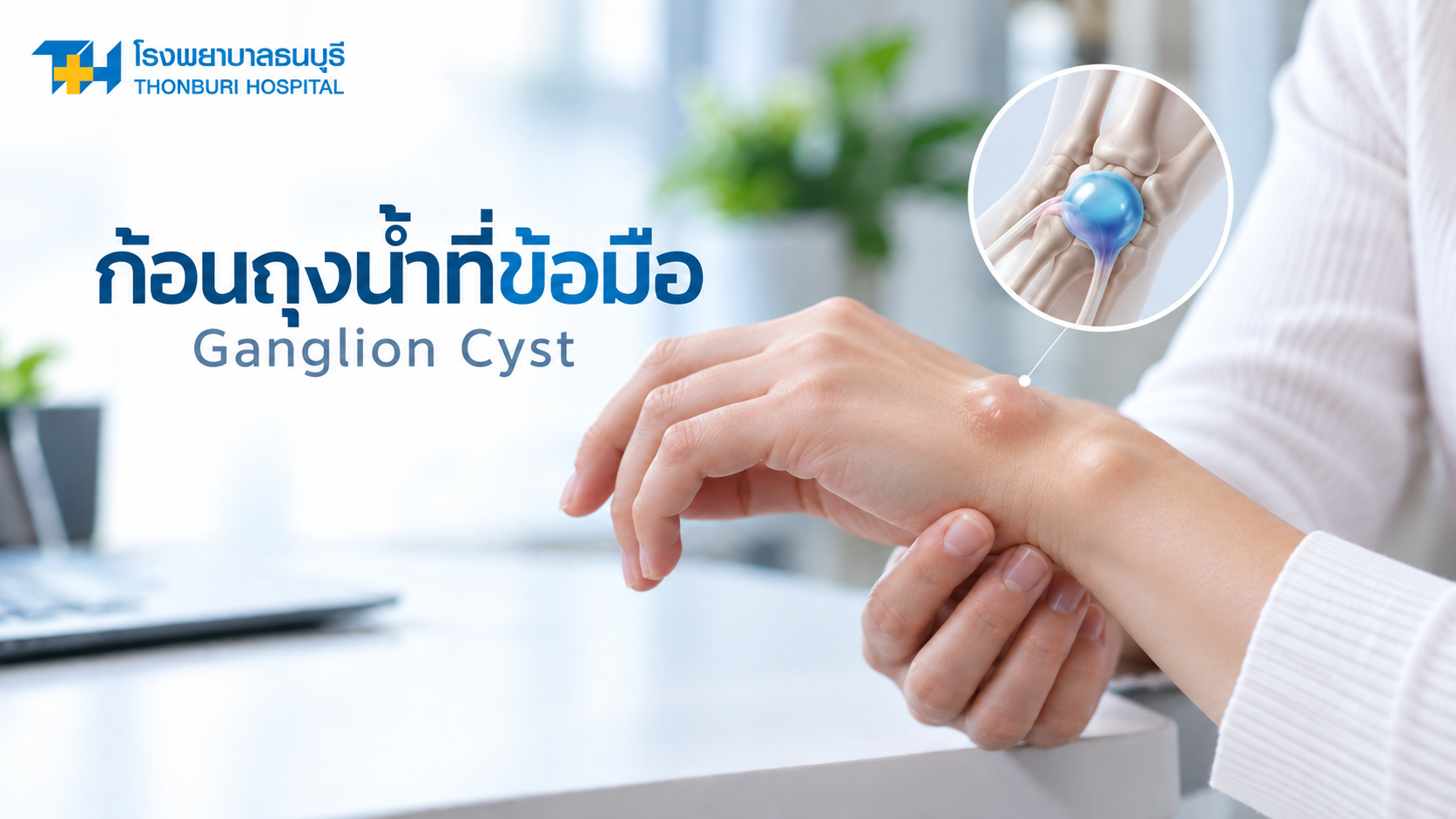 Ganglion Cyst